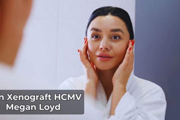 Skin Xenograft HCMV Megan Loyd